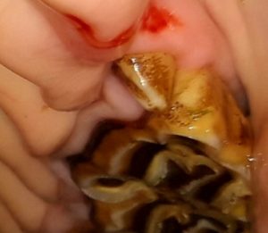 Dent de loup GEZARA 2,5 ans- kiliane-dentisterie-equine.com