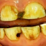 Carie dents lactéales IZARA 1 an- Photo kiliane-dentisterie-equine.com